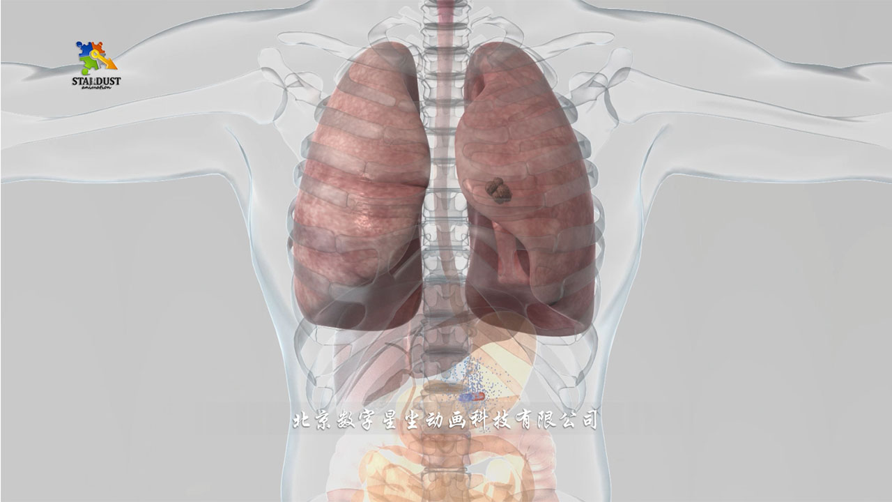 医学动画制作主图突出.jpg